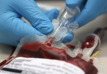 Diana Agacy, Blood Transfusion Nurse Practitioner and Phlebotomy Manager at University Hospital Southampton NHS Foundation gives an overview of the importance of patient safety during blood transfusions…