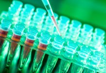 The growing need for innovation in biobanking