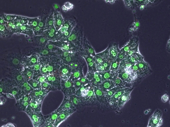 Image of liver cells (white outline) into which a probe heterocyclic compound has migrated and concentrated in the nuclei (green).