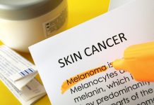 Skin cancer prevention in Europe