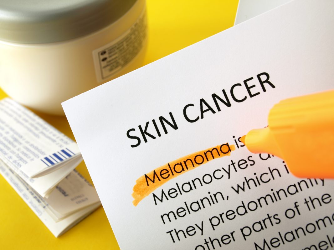 melanoma prevention