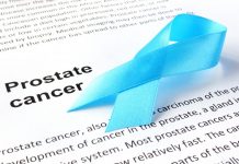 Million dollar question in prostate cancer research