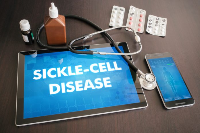 Sickle Cell research, Ireland