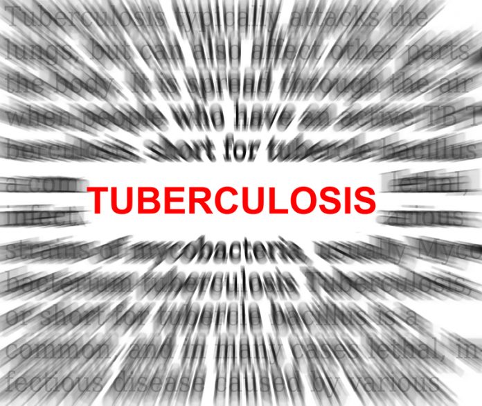 tuberculosis