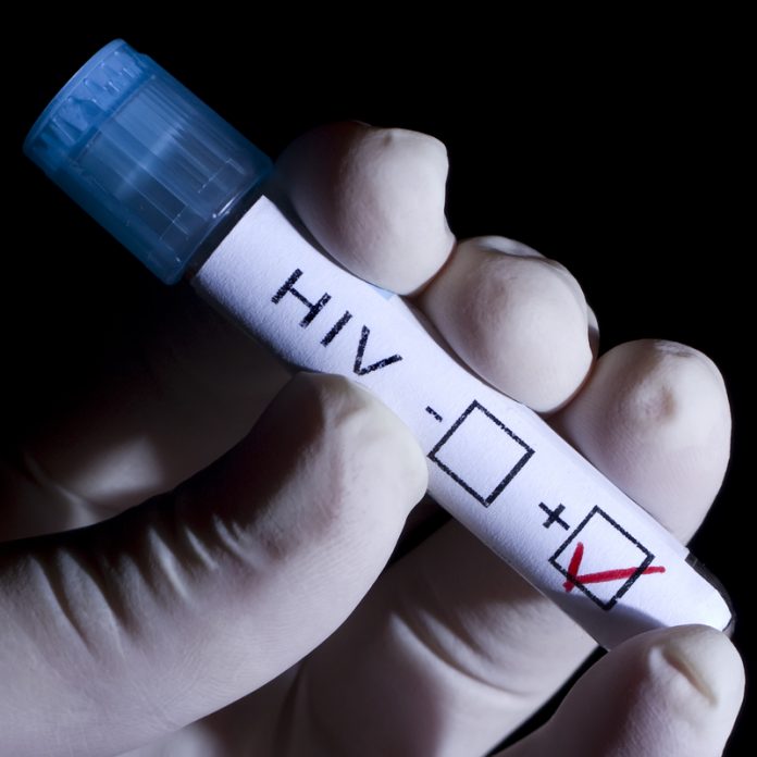 HIV