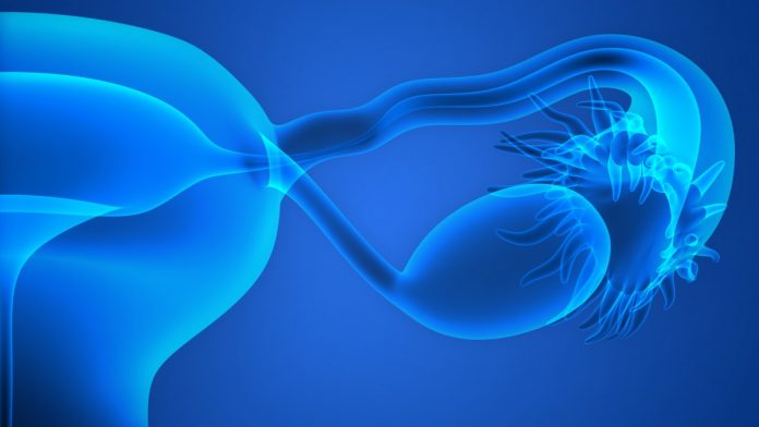 treatment of ovarian cancer