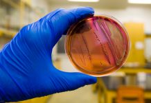 Food safety test petri dish