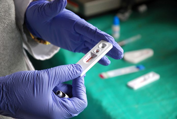 HIV transmission testing kit gloved hands