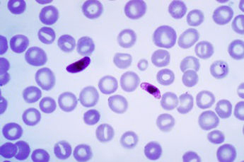 Plasmodium falciparum malaria parastie