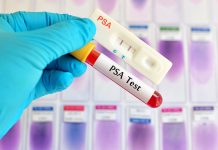 treatments for prostate cancer psa test