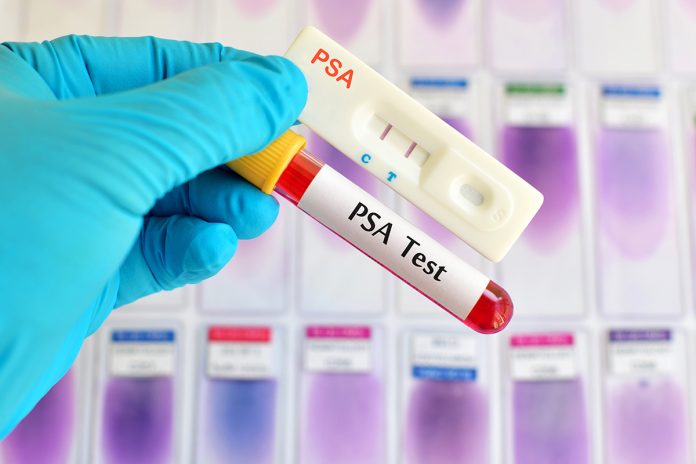 treatments for prostate cancer psa test