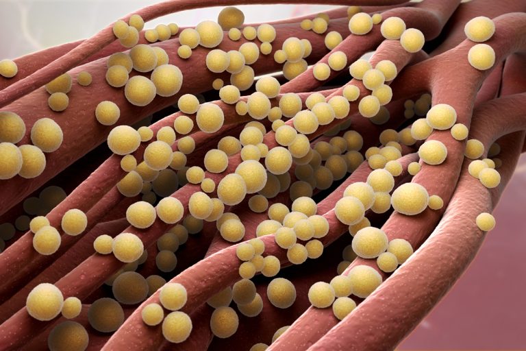 The evolution of Staphylococcus aureus