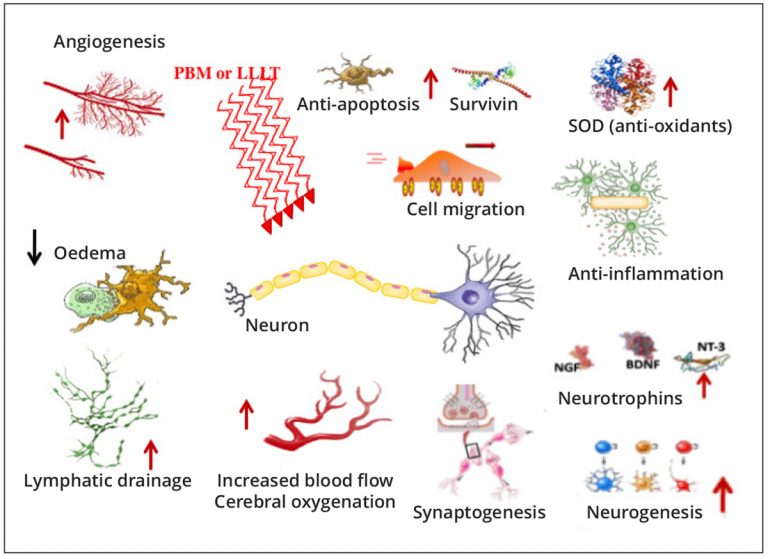 Can a new light-based therapy help with Alzheimer’s disease?