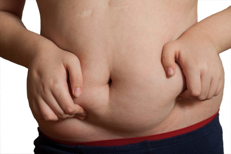 New plans to reduce childhood obesity in the UK unveiled