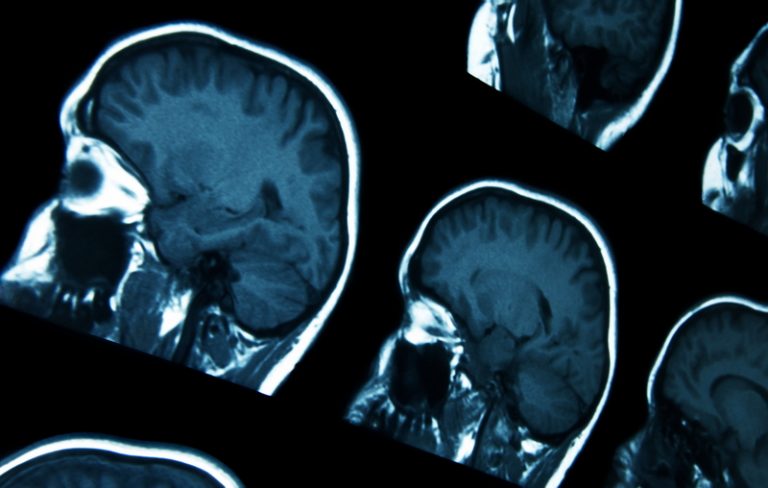 Imaging cerebral blood flow with single capillary resolution