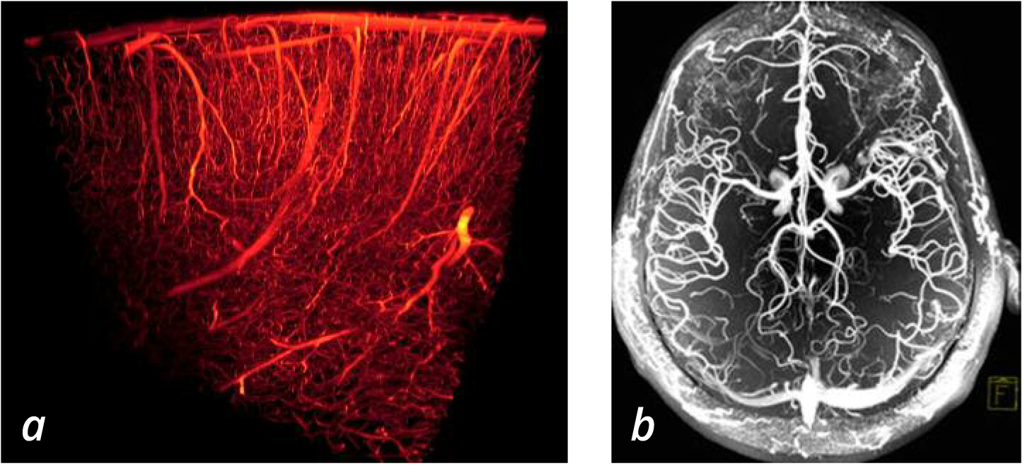 cerebral blood flow