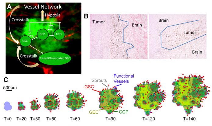 glioblastoma