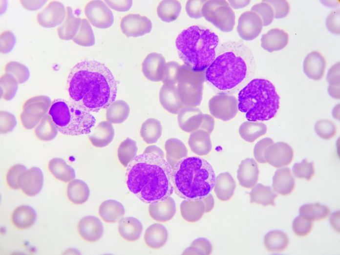 acute leukaemia