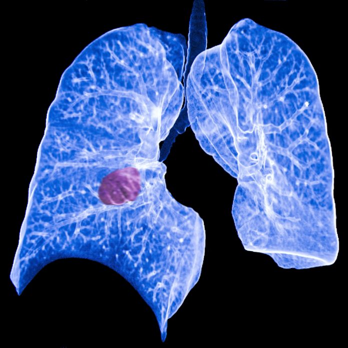 lung health