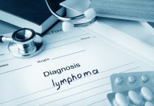 Lymphoma