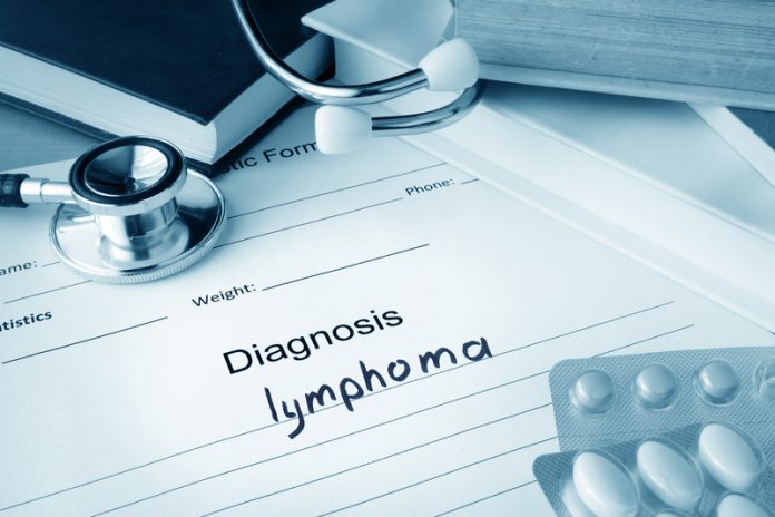 Lymphoma