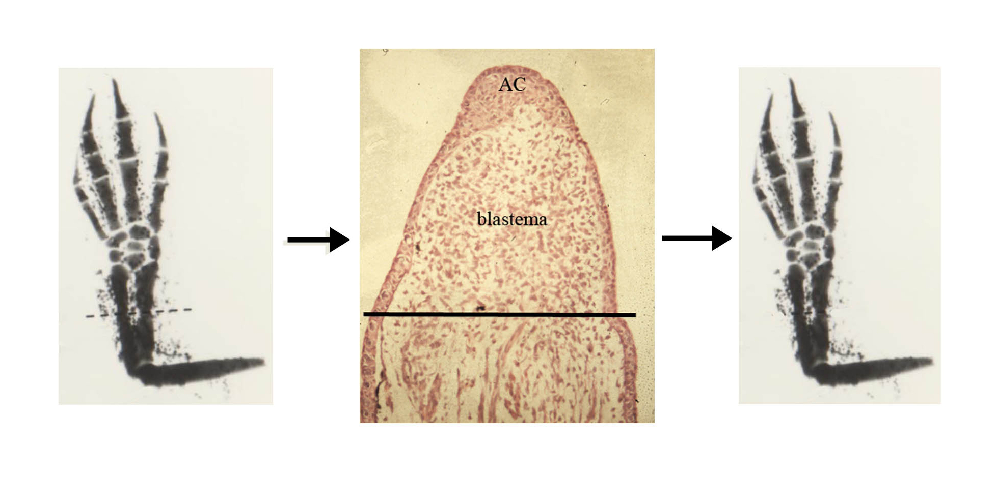 Regenerative medicine