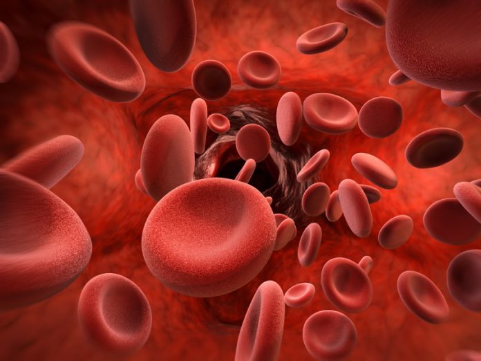 aplastic anaemia