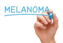 malignant melanoma