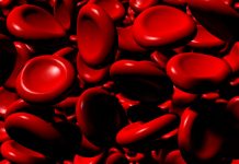 Aplastic Anaemia