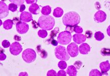 acute myeloid leukaemia