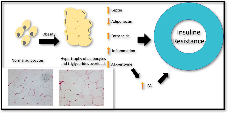 Diabetesmellitus Types Risk Factors Symptoms Treatments