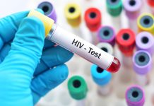 HIV diagnoses