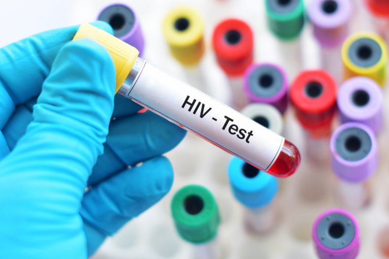 HIV diagnoses