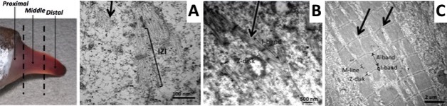 tissue regeneration