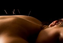 acupuncture