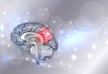 neurodegenerative disorders