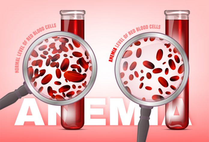 iron deficiency, anaemia