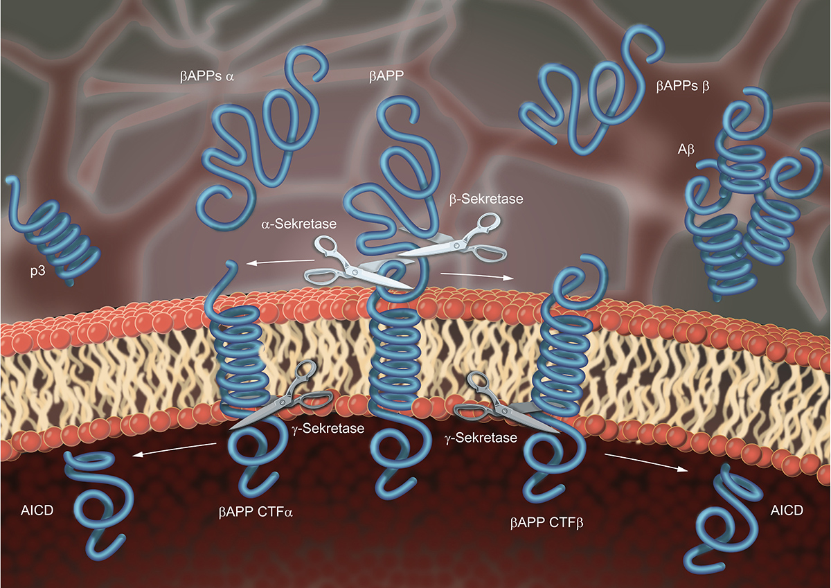 neurodegenerative diseases