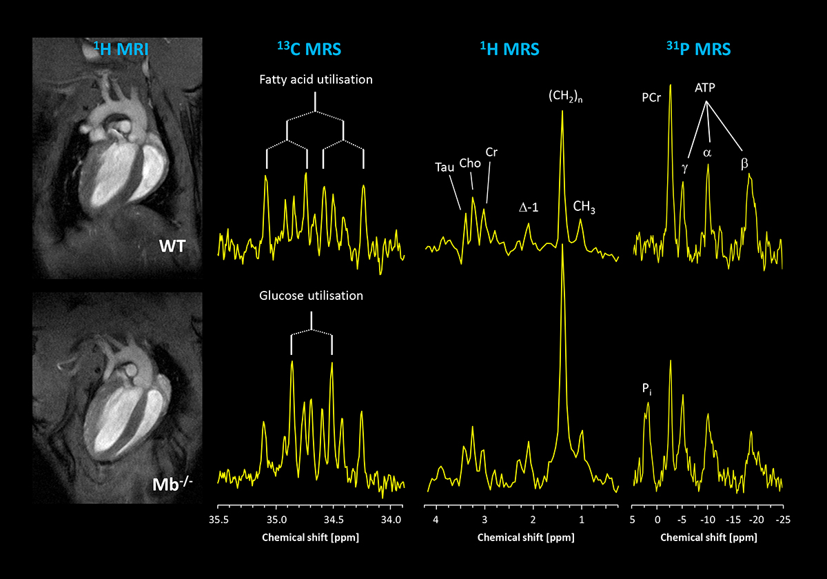 Cardiovascular magnetic resonance