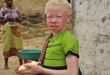 albinos in malawi, malawi's elections