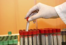 red blood cells, european red cell society