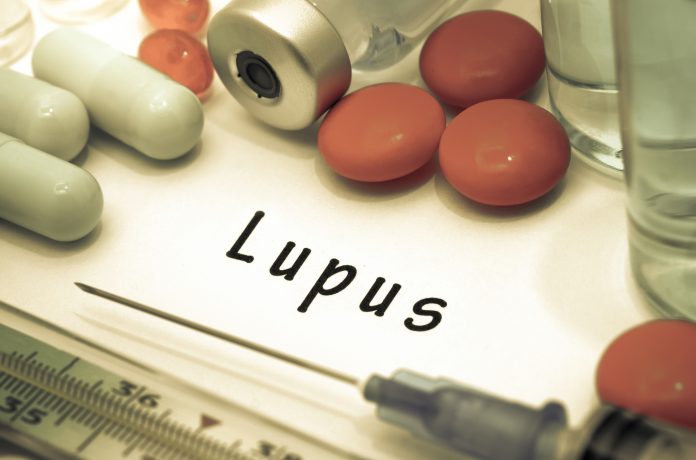 systemic lupus erythematosus