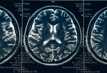 brain disorders in europe, european brain council