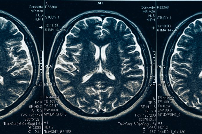 brain disorders in europe, european brain council