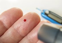 prevention of type 1 diabetes