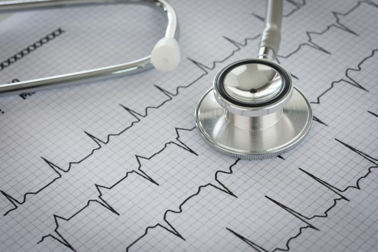 cardiopulmonary bypass, semi-automated circulatory system