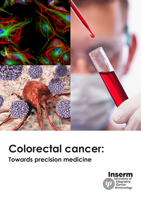 Colorectal cancer