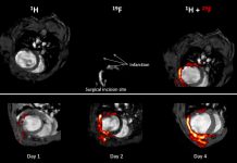 imaging and spectroscopy