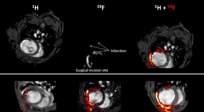 imaging and spectroscopy