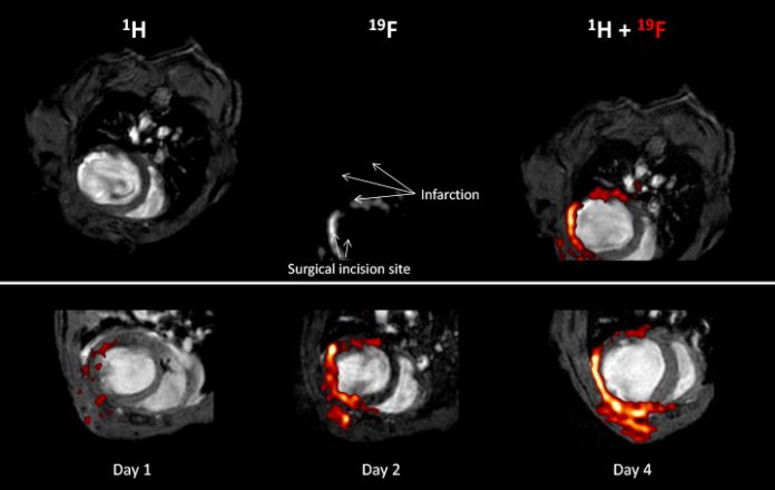 imaging and spectroscopy